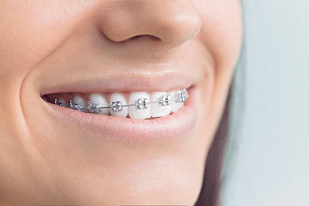 Best Teeth Whitening  in Dickson, OK